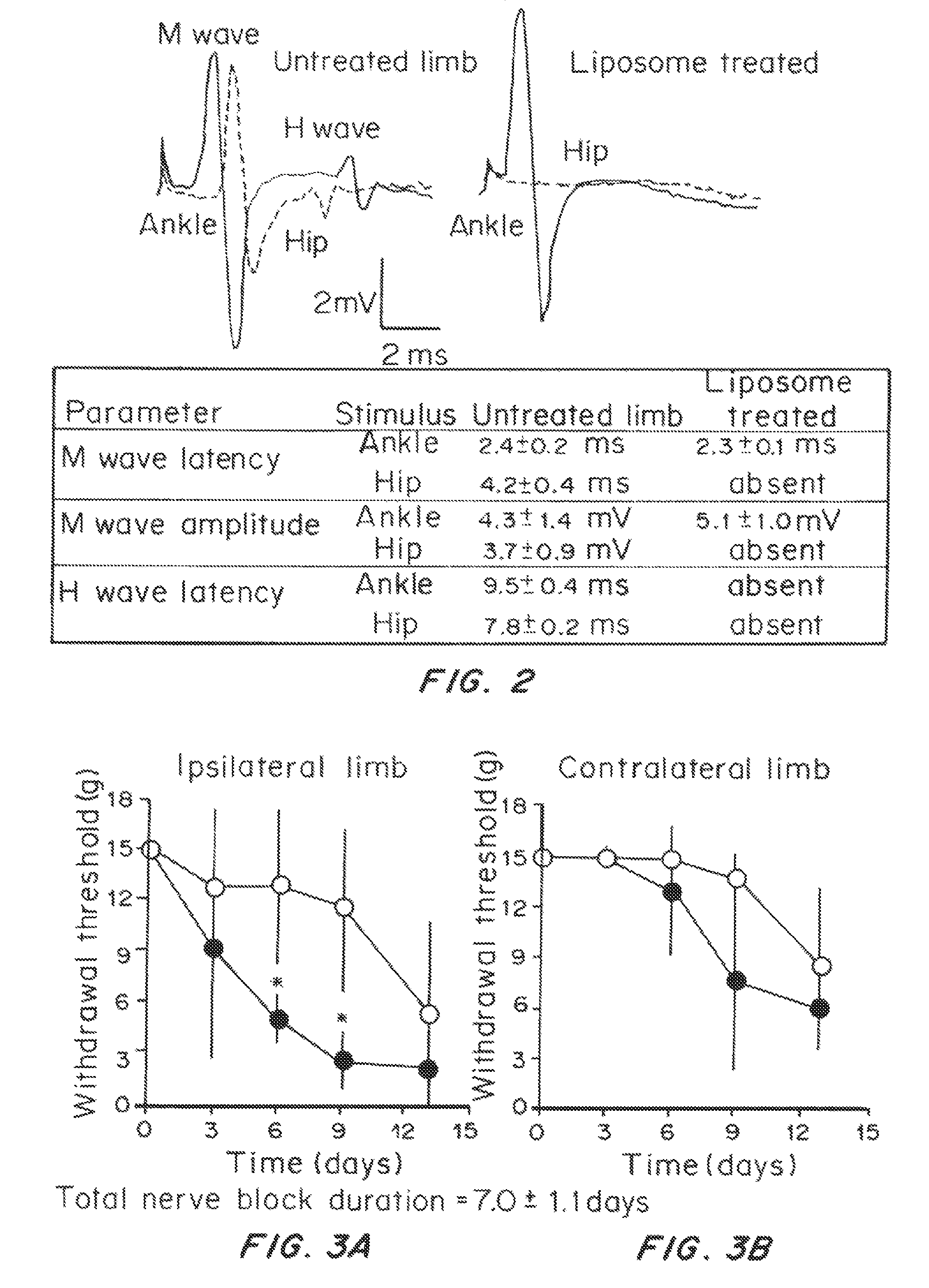 Formulations and methods for delaying onset of chronic neuropathic pain