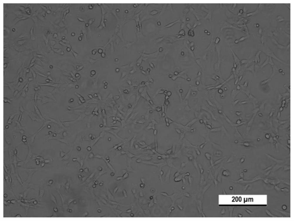 Mesenchymal stem cell cryopreservation medium, cryopreservation method, preservation kit and recovery method