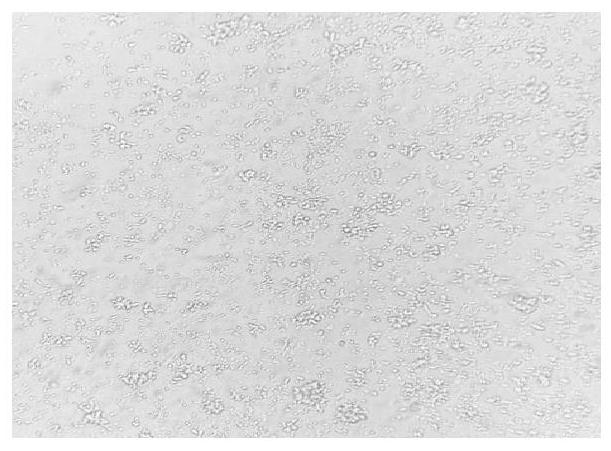 Reagent and reagent kit for in vitro culture of NK cells through union of dual antibodies and thymosin, and culture method