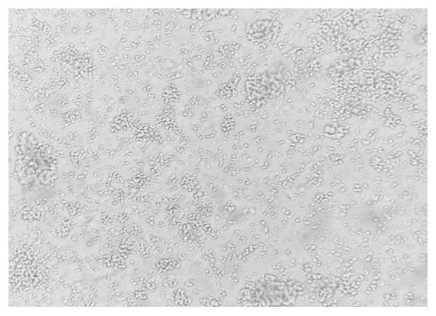 Reagent and reagent kit for in vitro culture of NK cells through union of dual antibodies and thymosin, and culture method