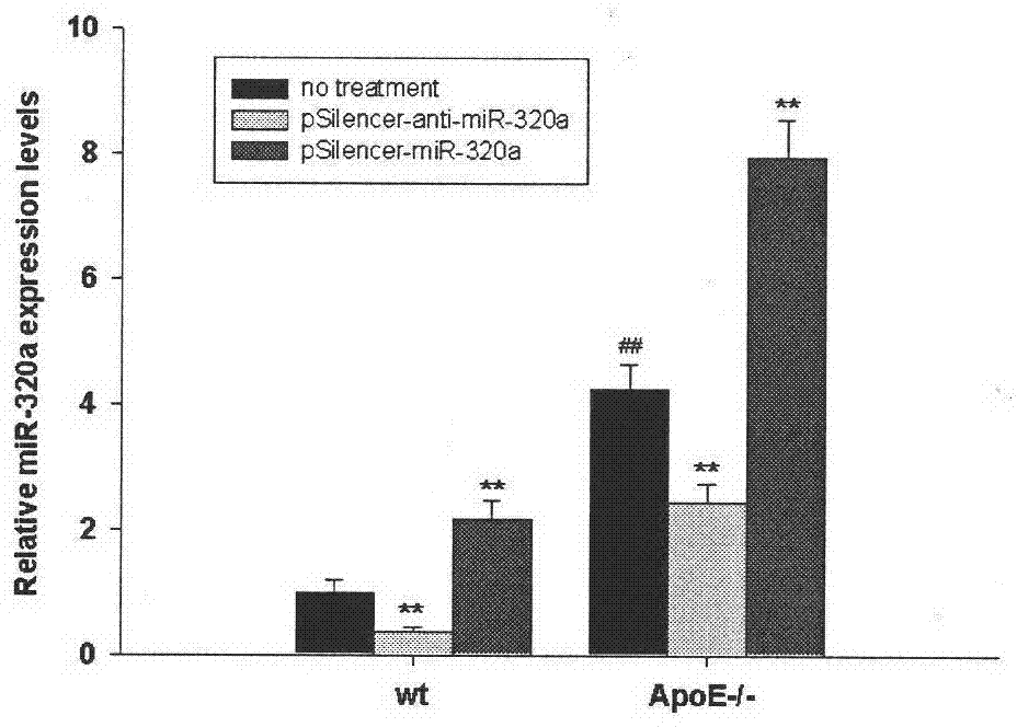 Application of microRNA-320(miR-320A) and its antisense nucleotide in diagnosis, prevention and treatment of cardiovascular diseases