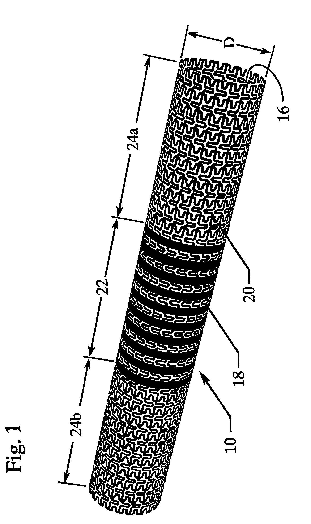 Pleated stent assembly