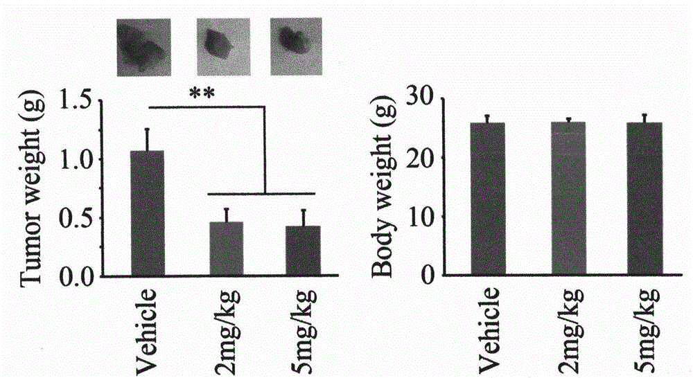 Anti-melanoma compound and application thereof