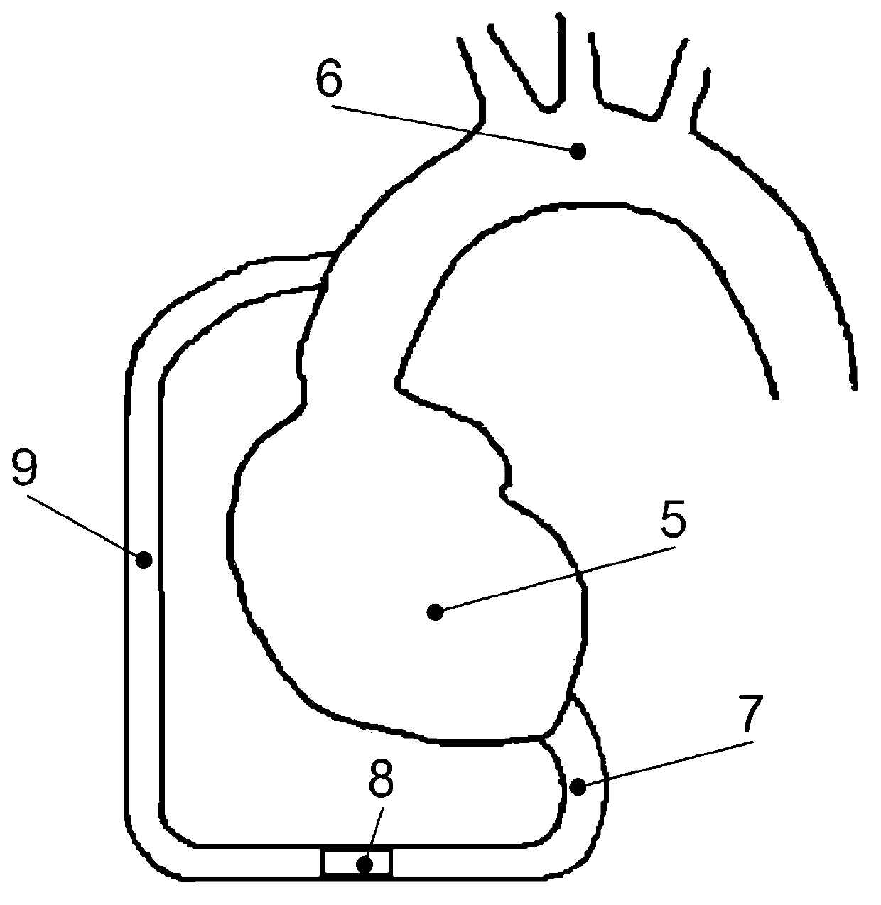 Auxiliary circulation blood pump adopted in serially connecting operation modes and installing method of auxiliary circulation blood pump