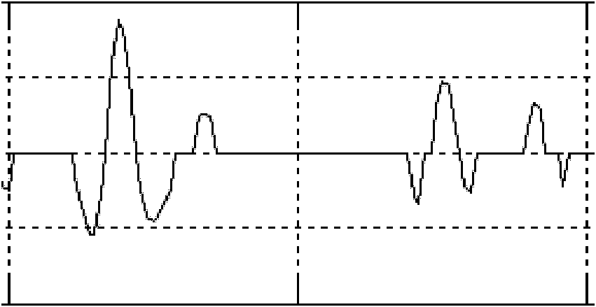 A Korotkoff sound blood pressure measurement and signal analysis method based on wavelet denoising