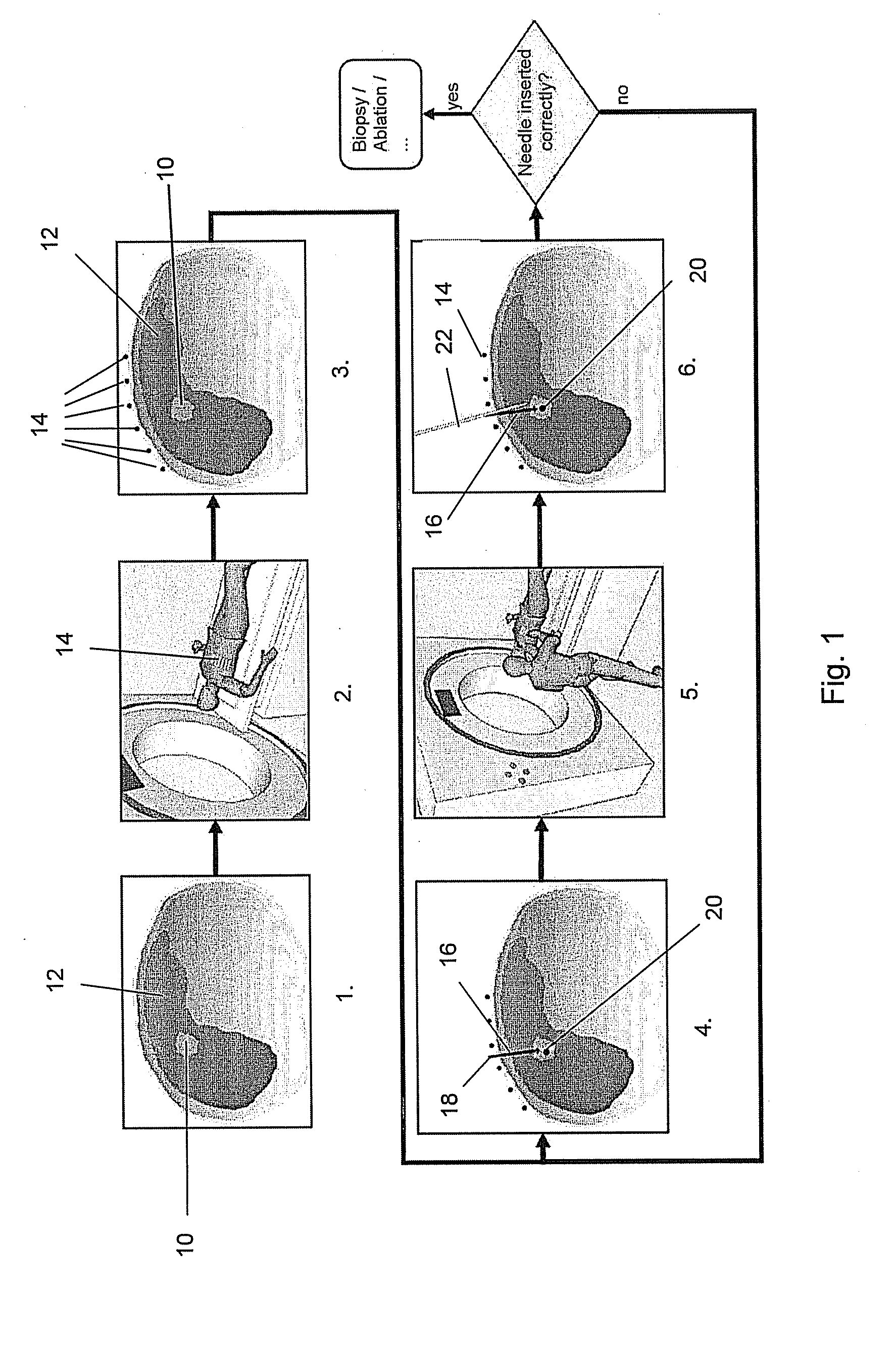 Method, system and computer program product for targeting of a target with an elongate instrument