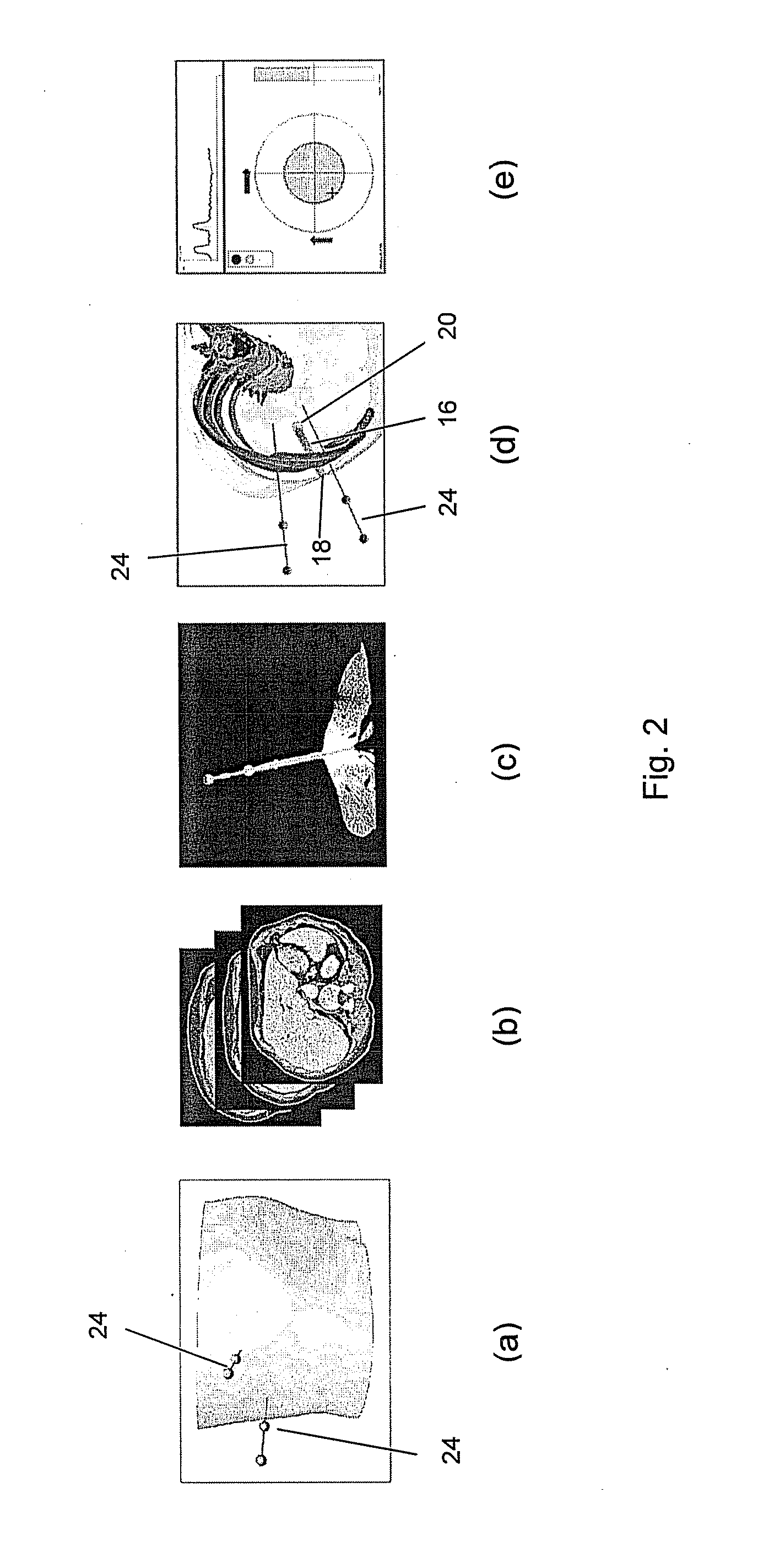 Method, system and computer program product for targeting of a target with an elongate instrument