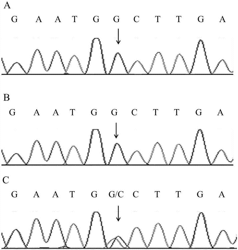 Pathogenic gene mutation of hypothyroidism and diagnostic reagent based on same