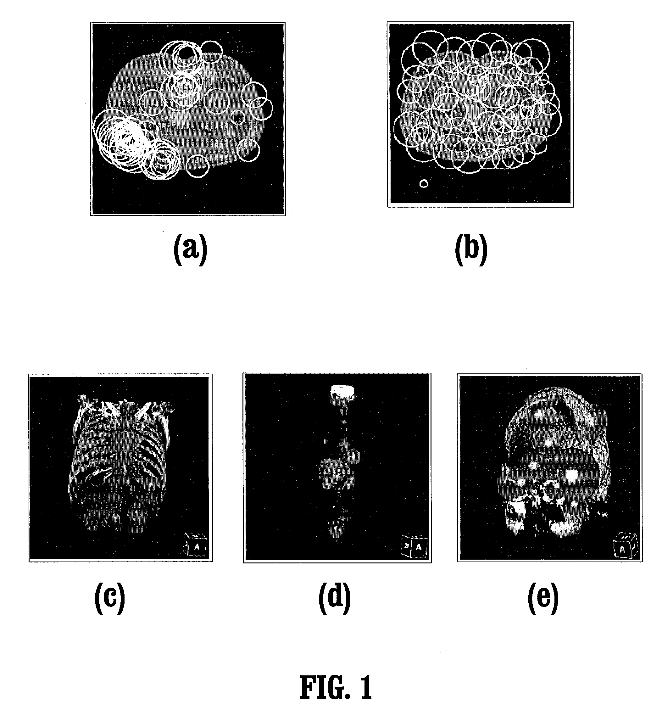System and method for salient region feature based 3D multi modality registration of medical images