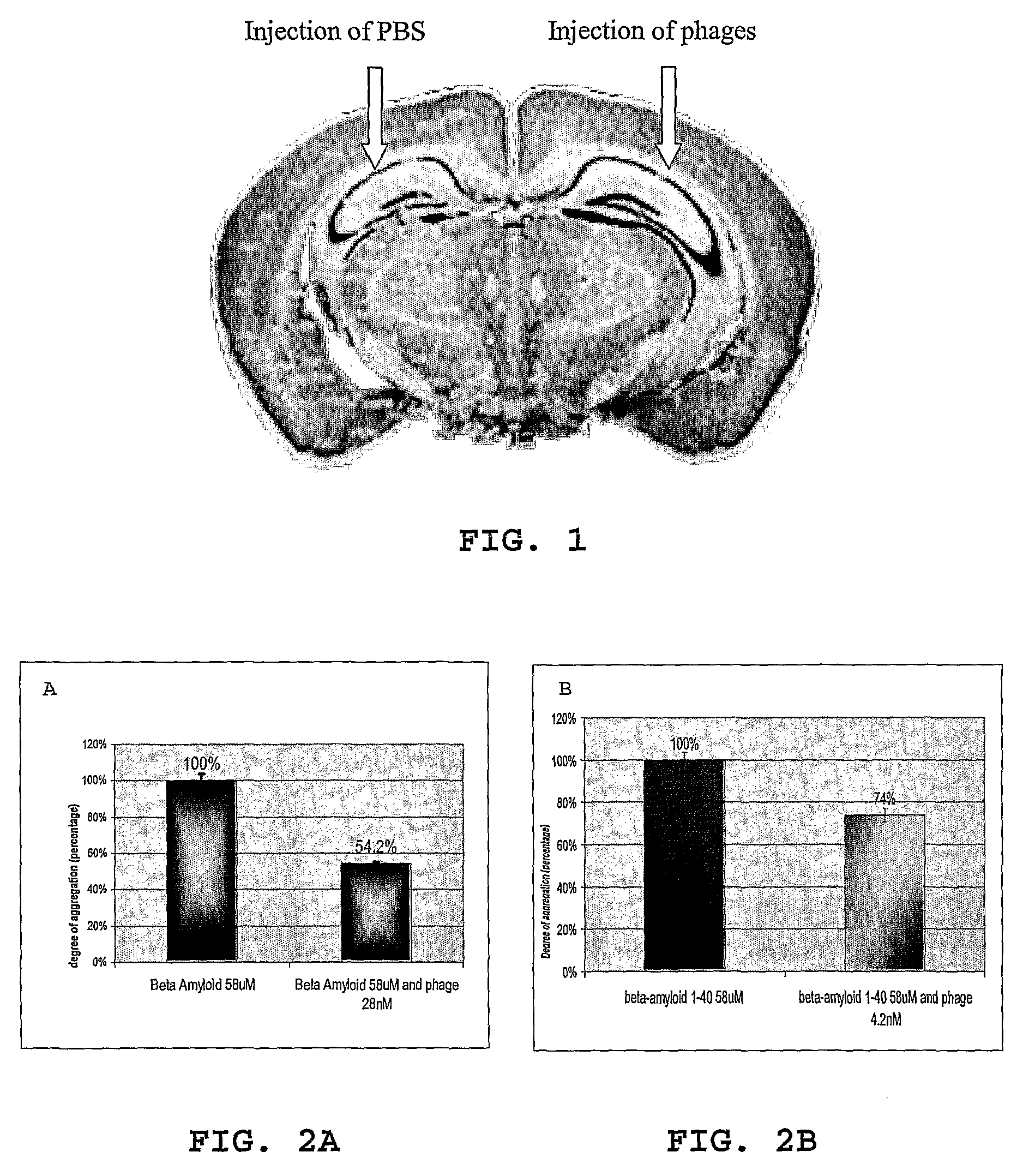 Method for treating inflammation associated with amyloid deposits and brain inflammation involving activated microglia