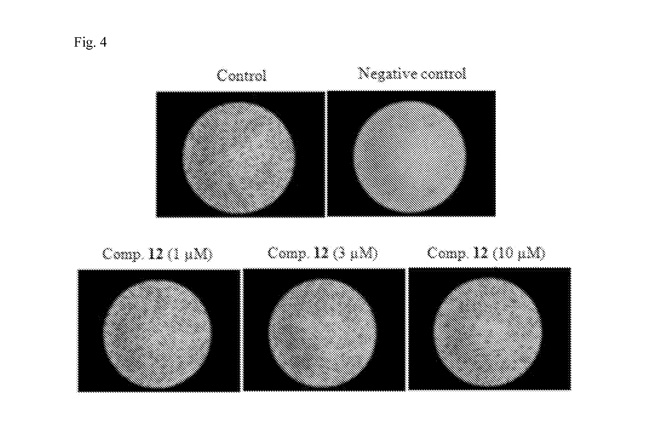 Pharmaceutical composition comprising bicyclic pyridinol derivatives for preventing or treating diseases caused by angiogenesis