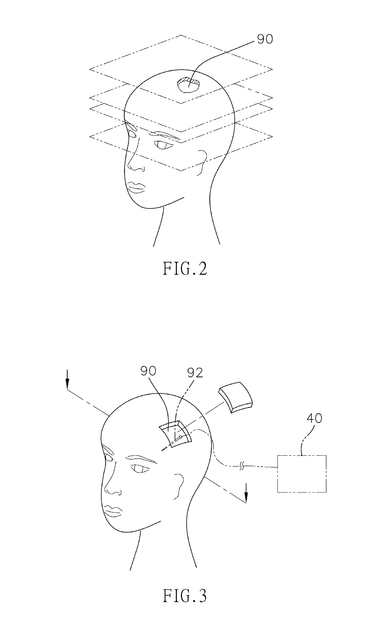 Image simulation system to covisualize electrodes and cortical vessels on 3D brain and its method