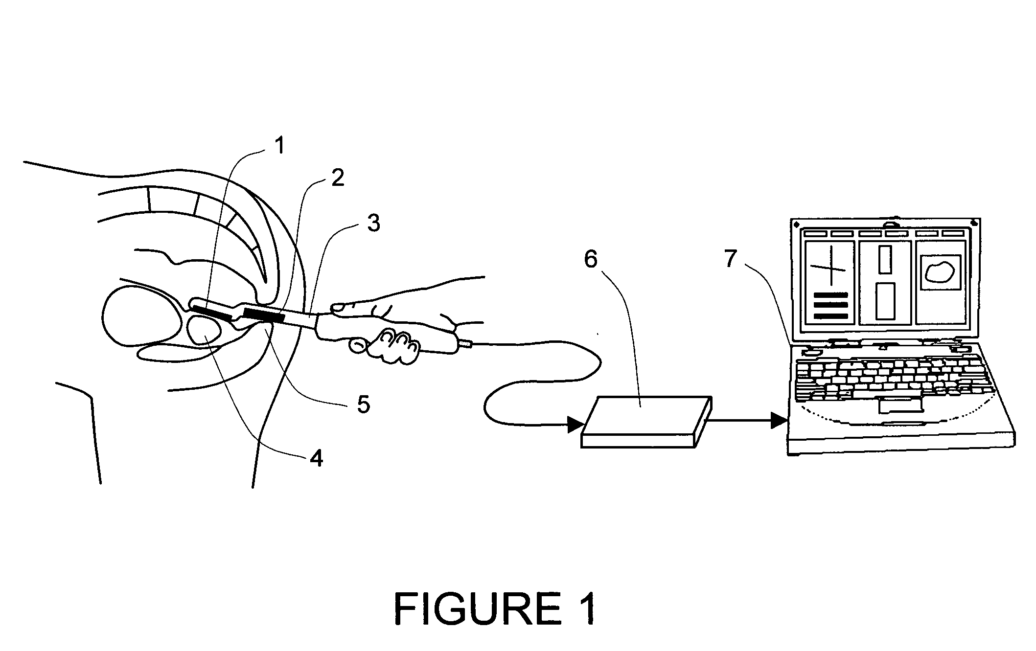 Method and a dual-array transducer probe for real time mechanical imaging of prostate