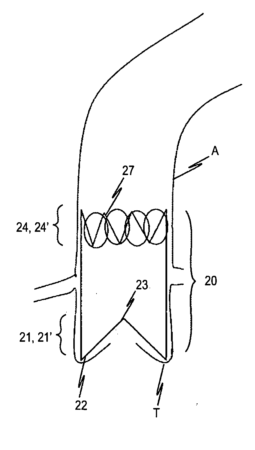 Device for the implantation and fixation of prosthetic valves