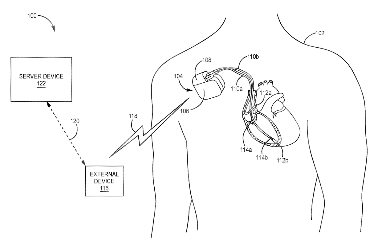 Facilitating integrity of telemetry connectivity between an implantable device and a remote device