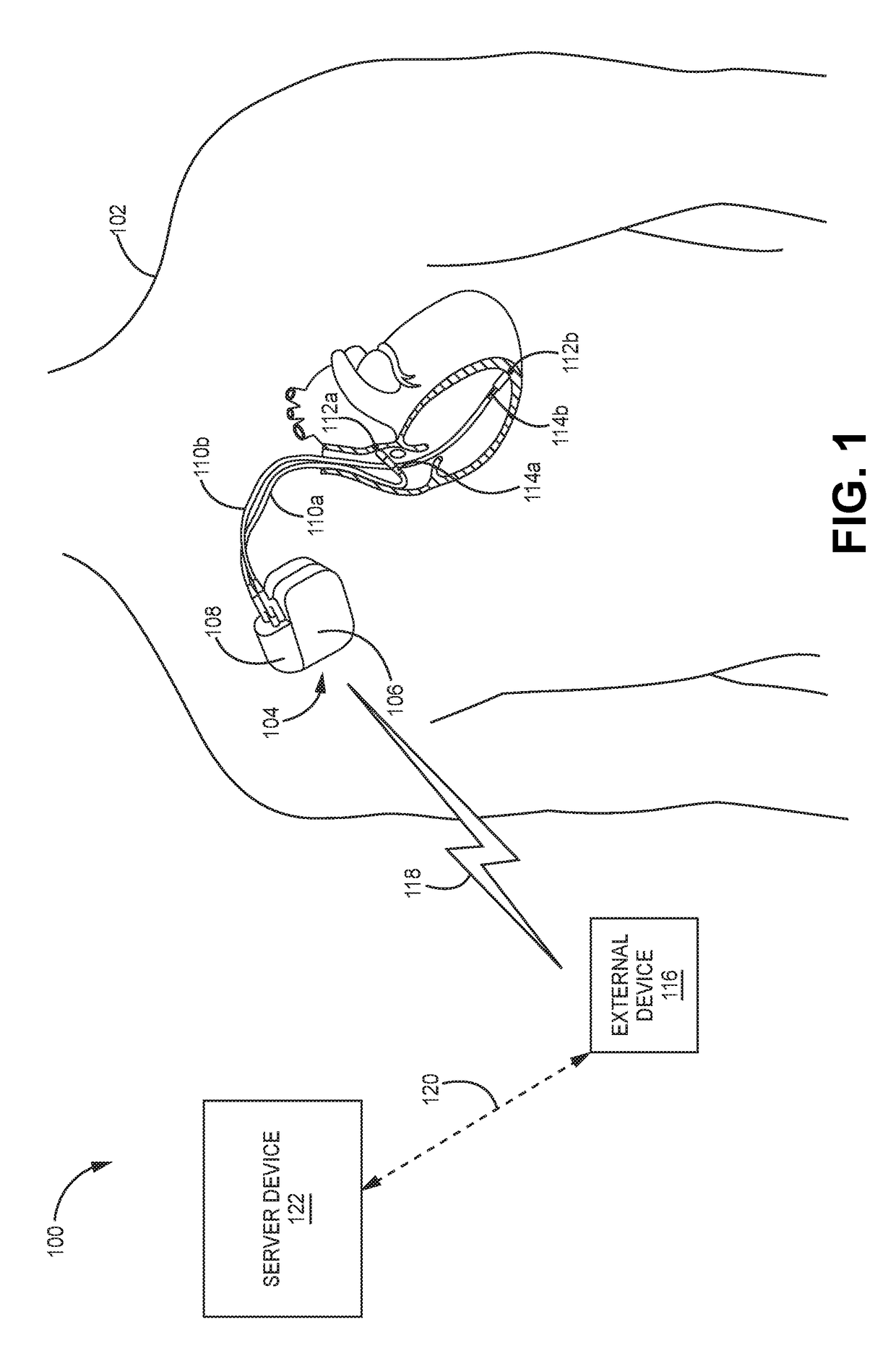 Facilitating integrity of telemetry connectivity between an implantable device and a remote device