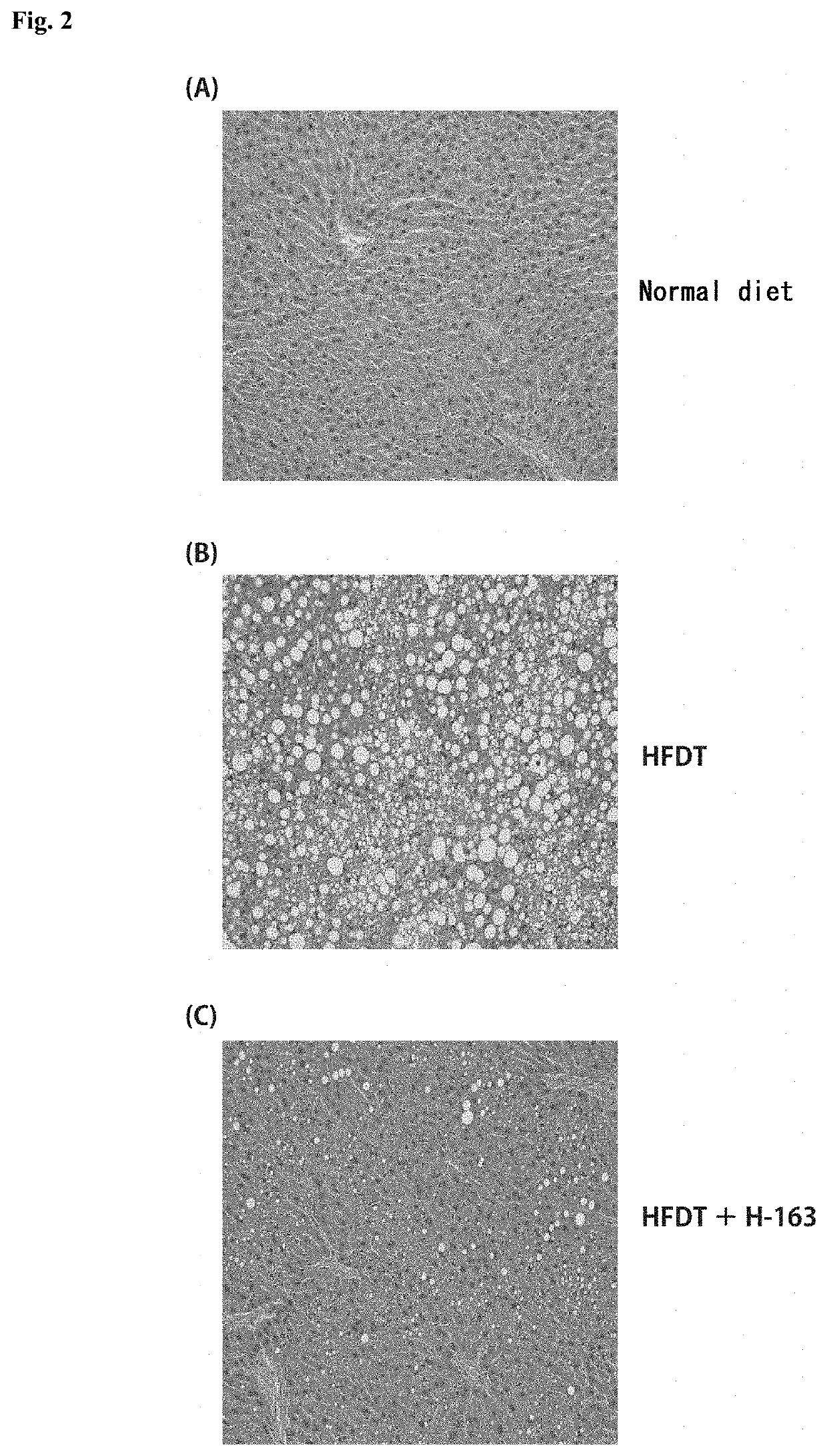 Therapeutic Agent for Fatty Liver Diseases and Therapeutic Agent for Adiposity