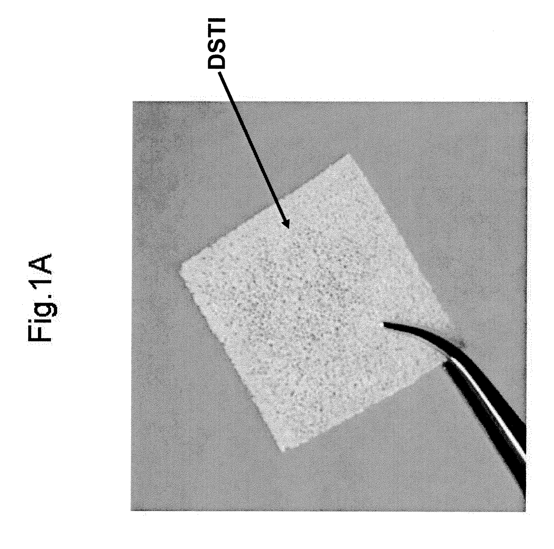 Method For Use Of A Double-Structured Tissue Implant For Treatment Of Tissue Defects