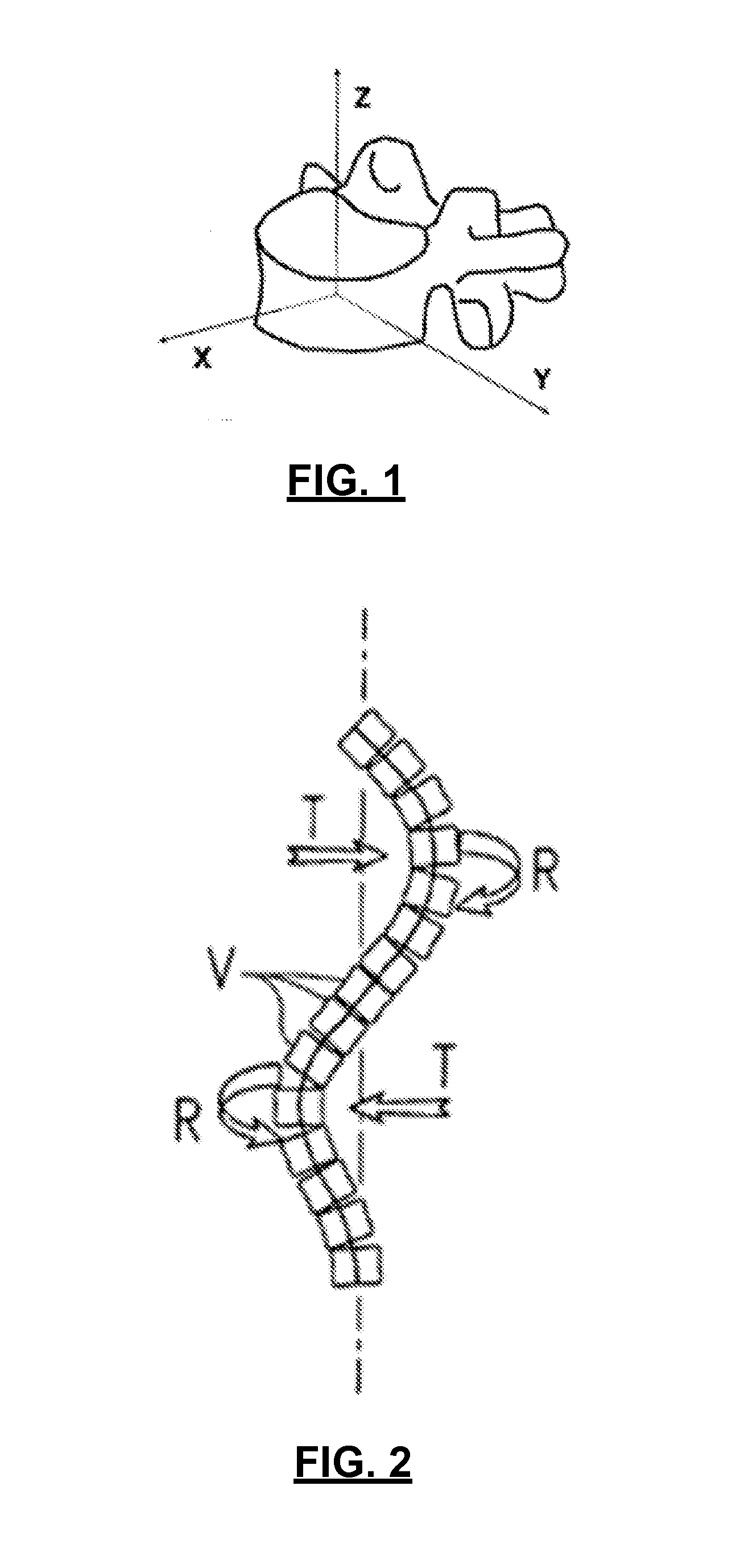 Spinal deformity correction instruments and methods