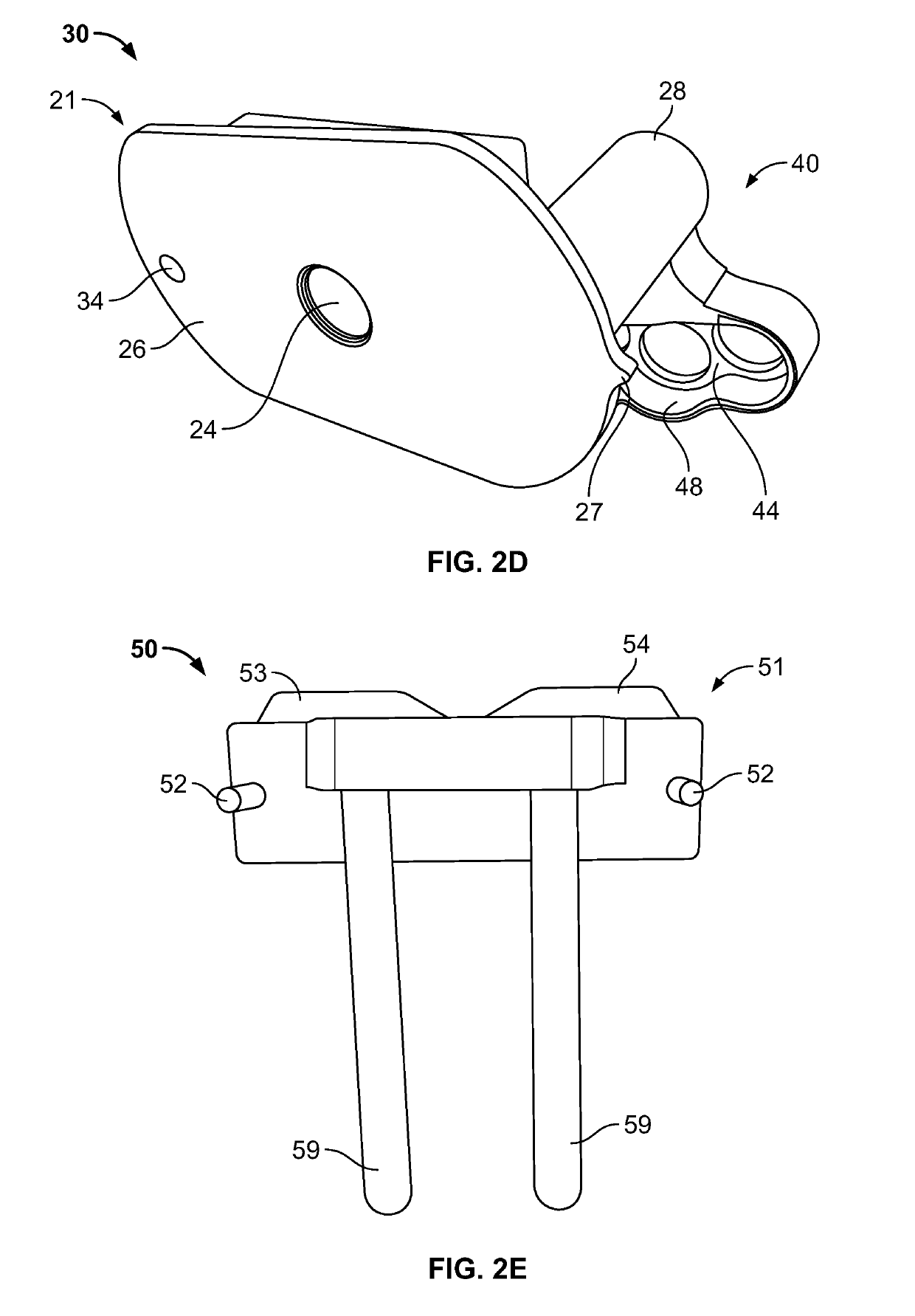 Globalized total knee instrumentation