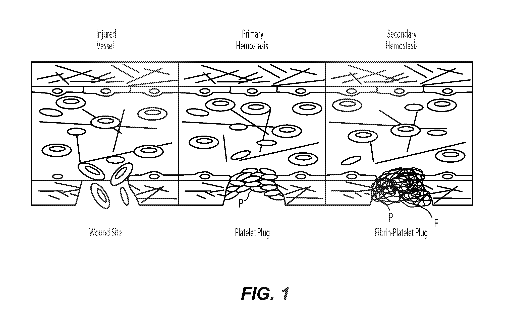 Fluidics devices for individualized coagulation measurements and associated systems and methods