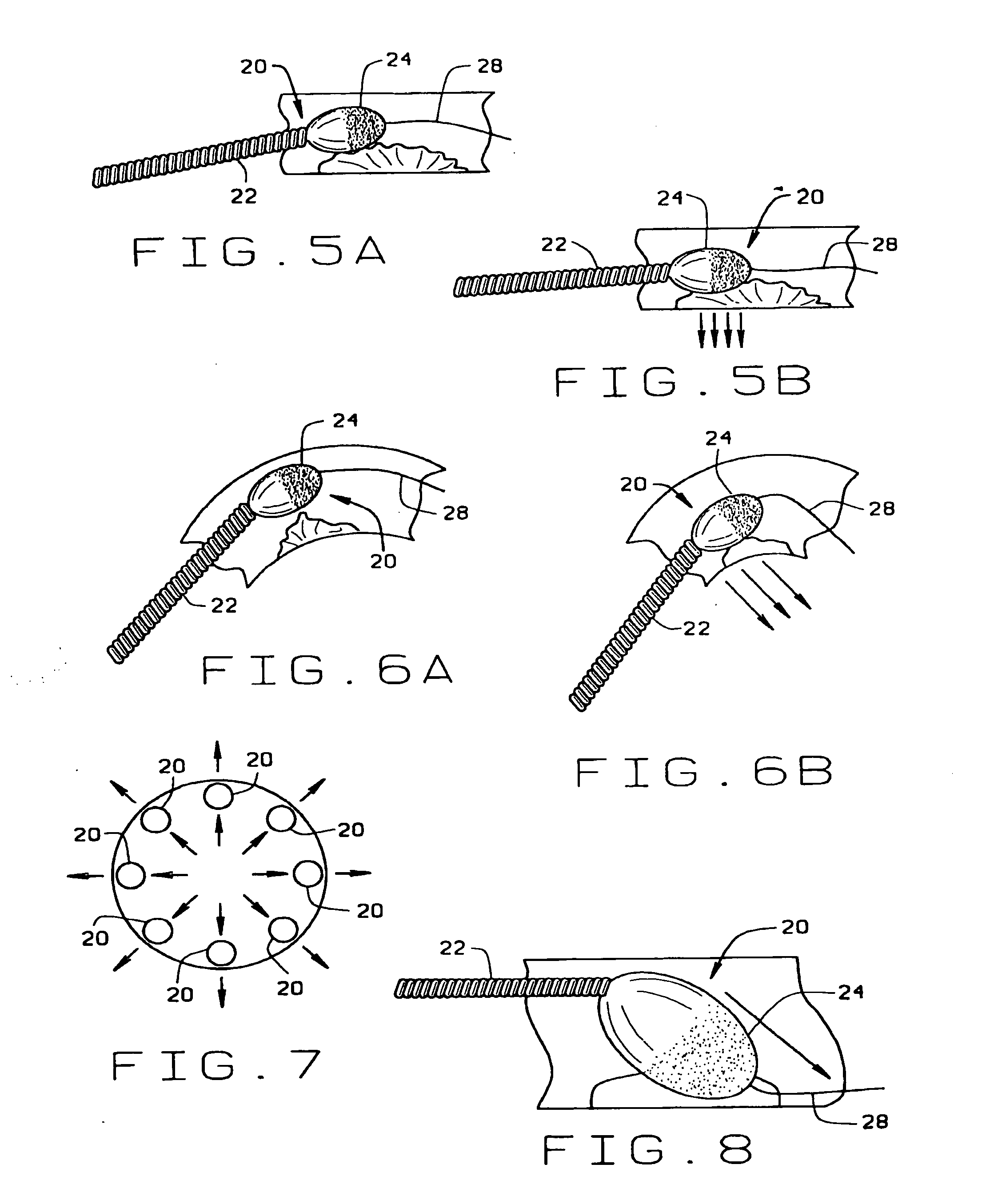 Magnetically navigable and/or controllable device for removing material from body lumens and cavities