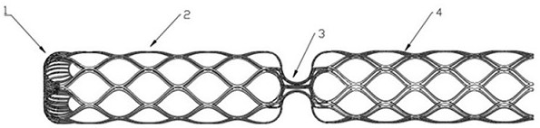 Self-screening thrombectomy stent with strong capture force