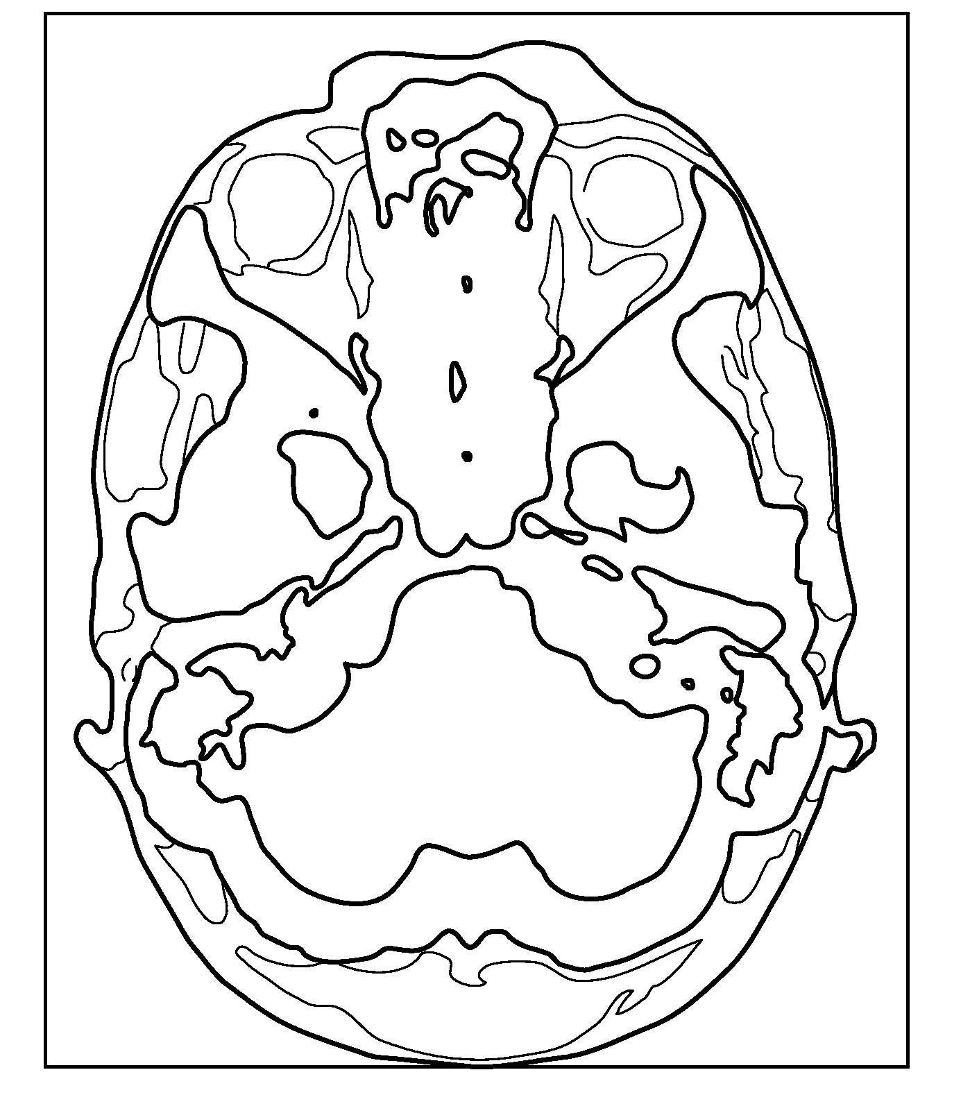 Medical image display apparatus, medical image display method and program