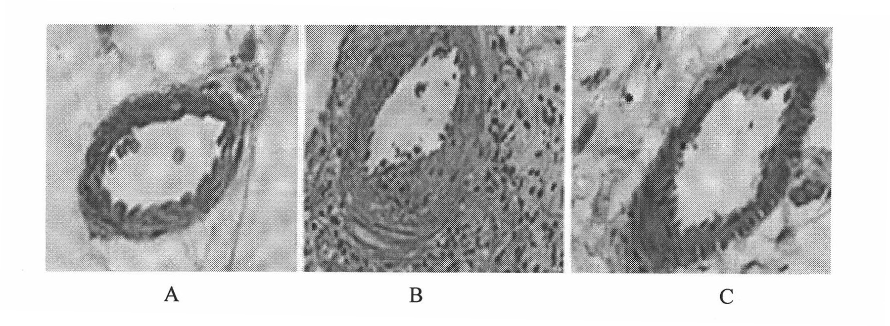 Medicament for preventing and treating small intestine transplantation chronic rejection and application thereof