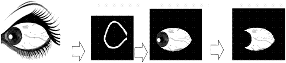 Complete extraction method of true color eye image graph white eye area