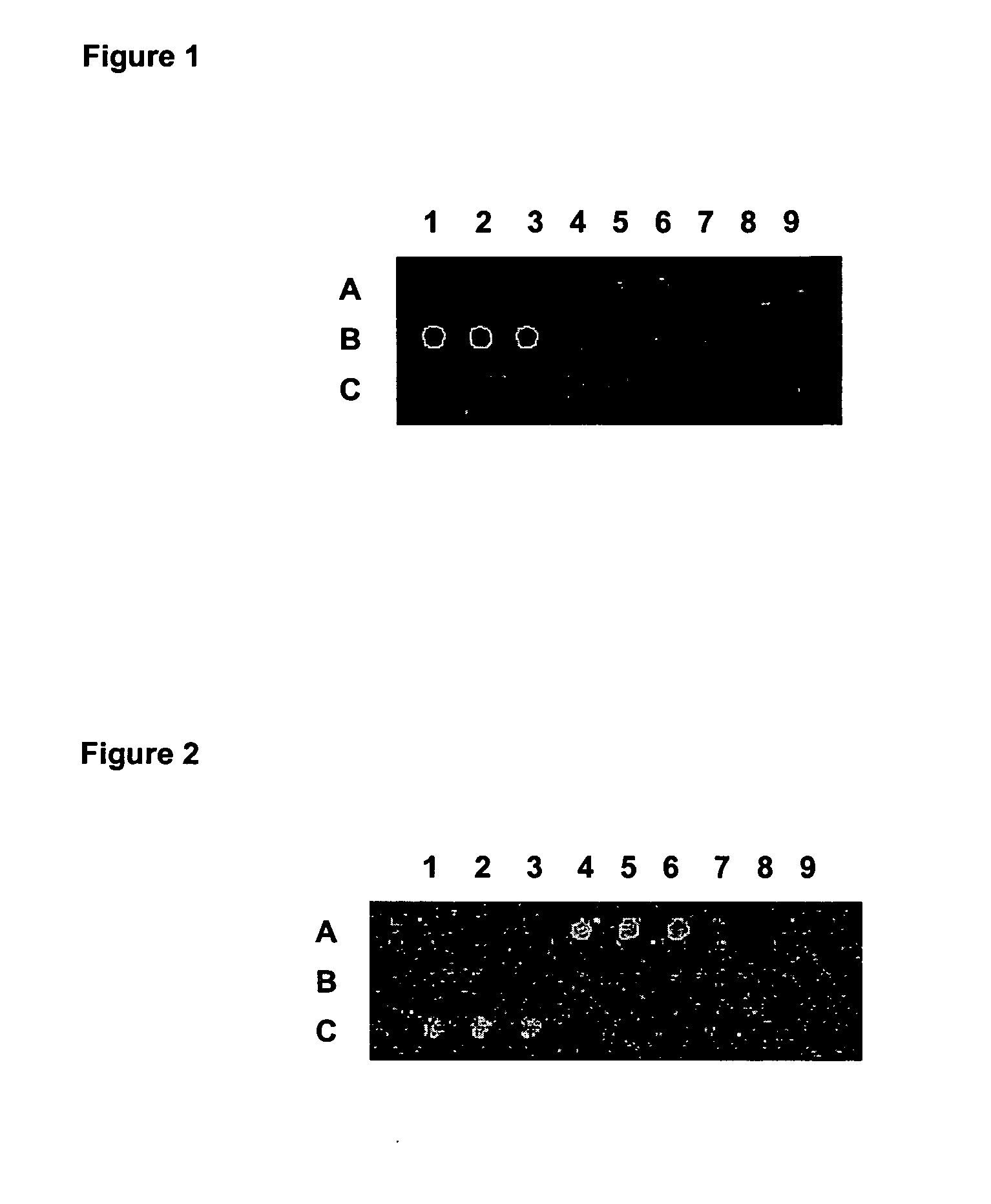 Method and array for detection and identification of microorangisms present in a sample using the genomic regions coding for different tRNA synthetases