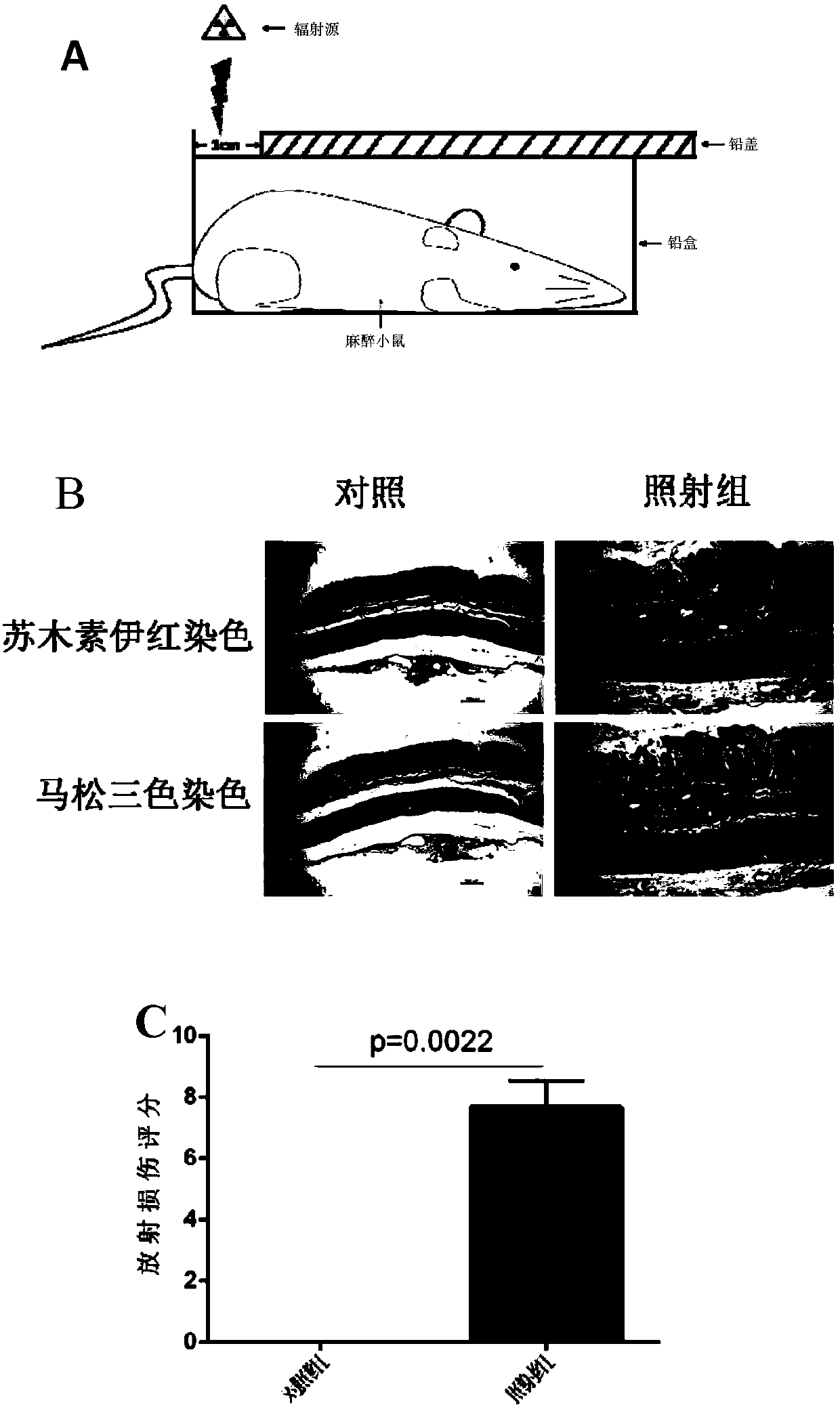 Application of PDGF inhibitor in preparation of medicines for treating intestinal inflammation diseases