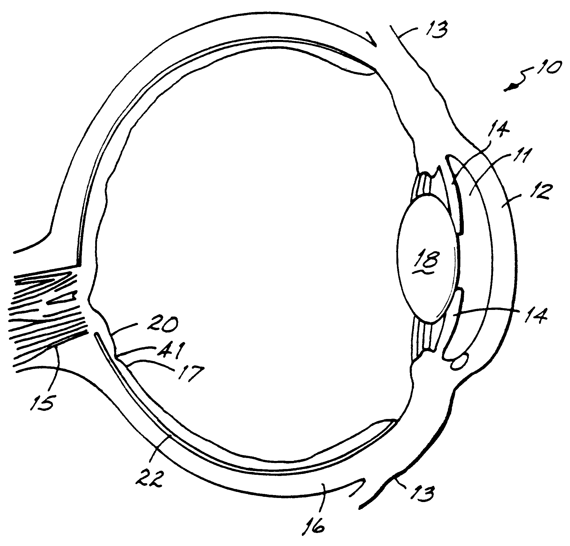Method of ocular treatment