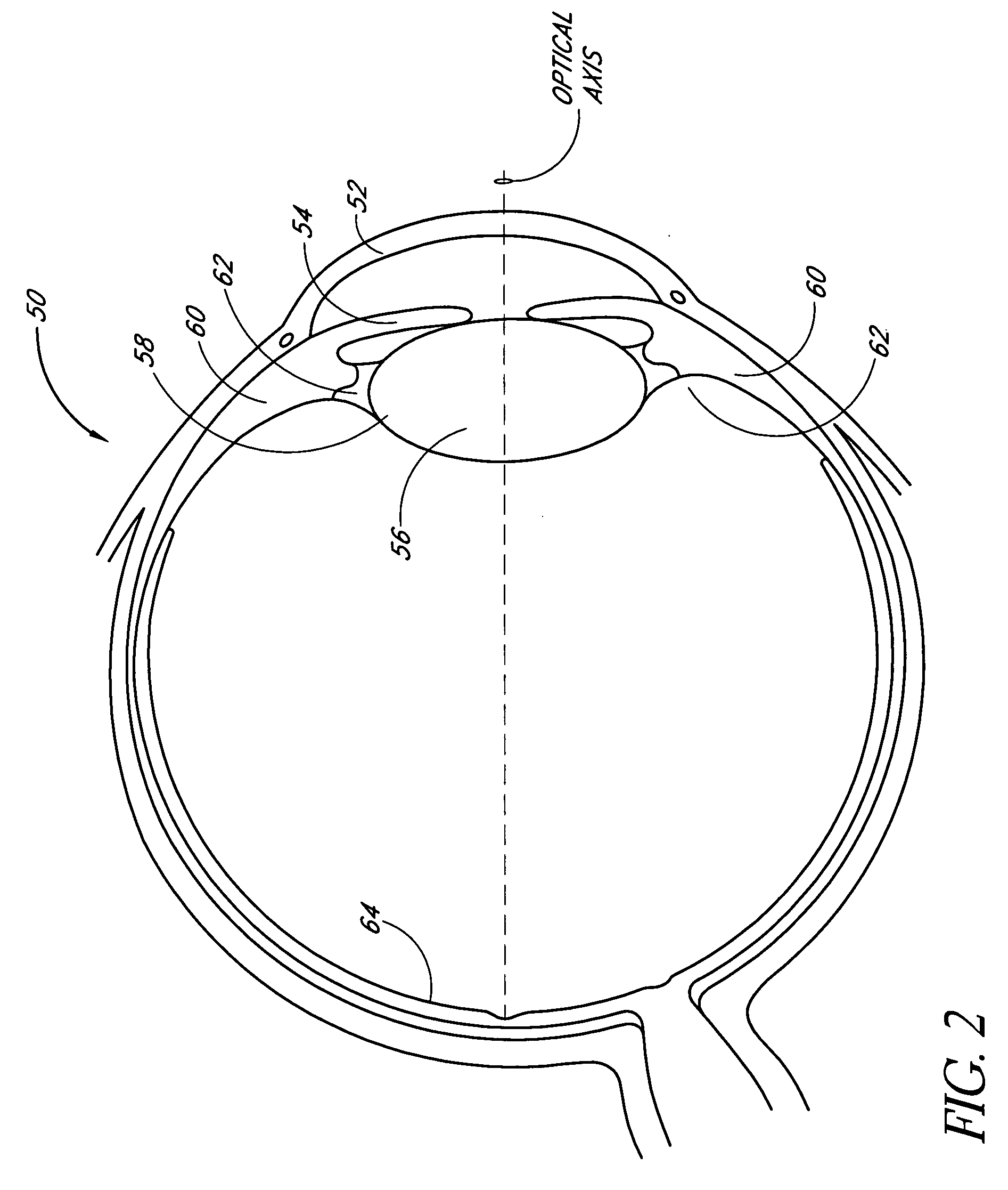 Method of preparing an intraocular lens for implantation