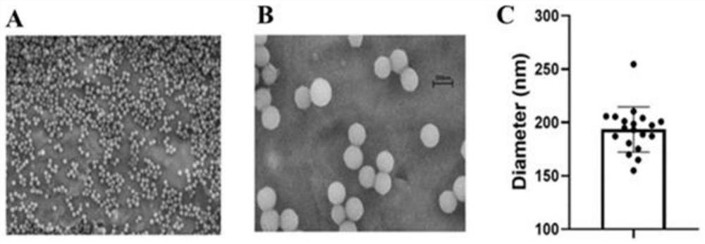 Nano-drug for preventing or treating cerebral ischemia-reperfusion injury as well as preparation method and application of nano-drug