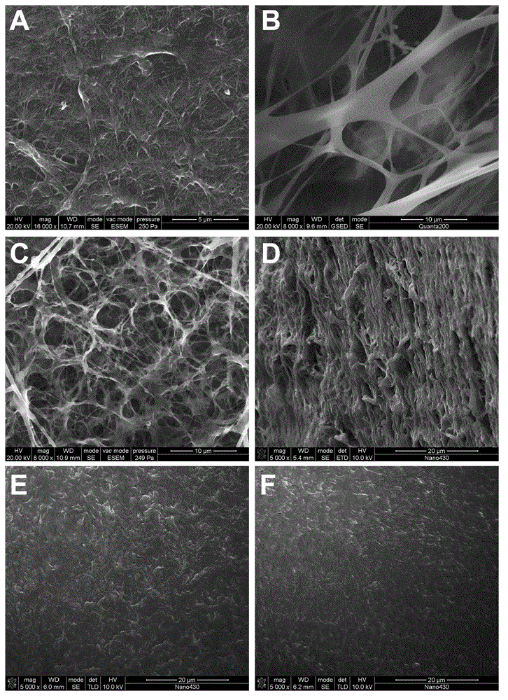 BC (Bacterial Cellulose)/PVA (Polyvinyl Alcohol) composite material, as well as preparation method and application thereof