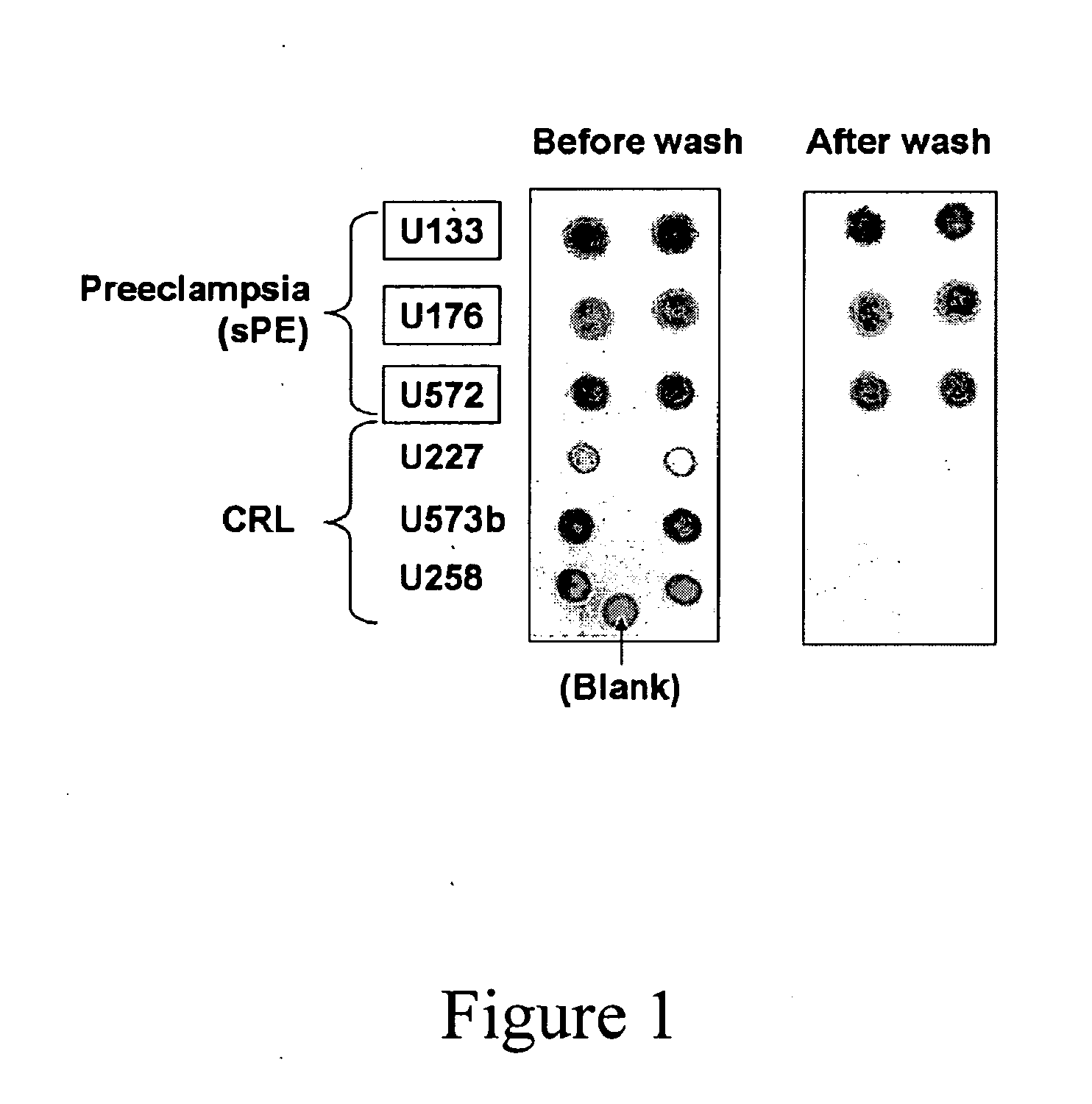 Methods and compositions for the detection and treatment of preeclampsia