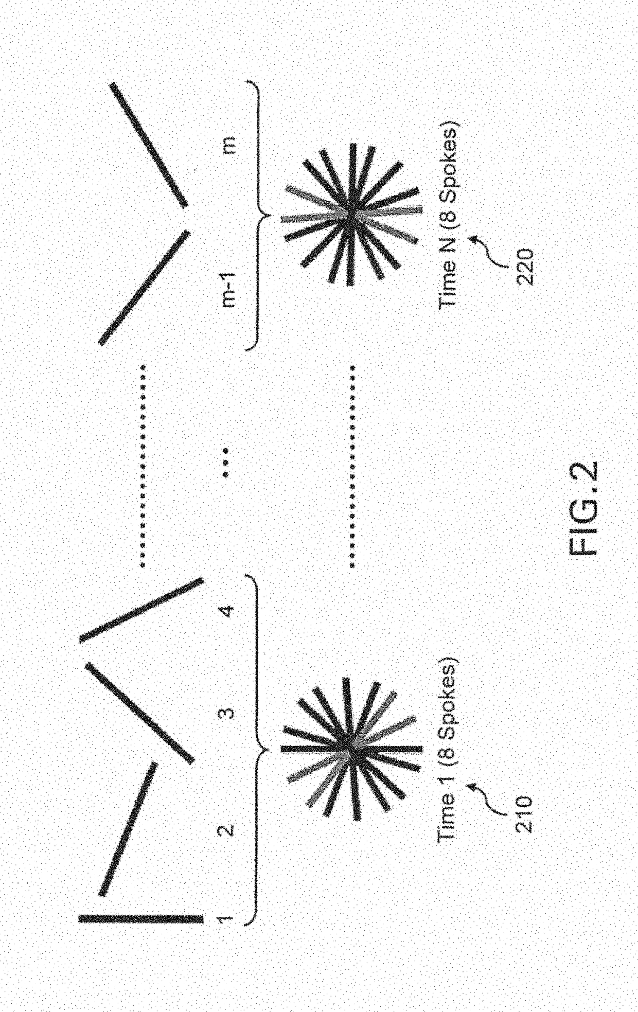 System, method and computer-accessible medium for highly-accelerated dynamic magnetic resonance imaging using golden-angle radial sampling and compressed sensing