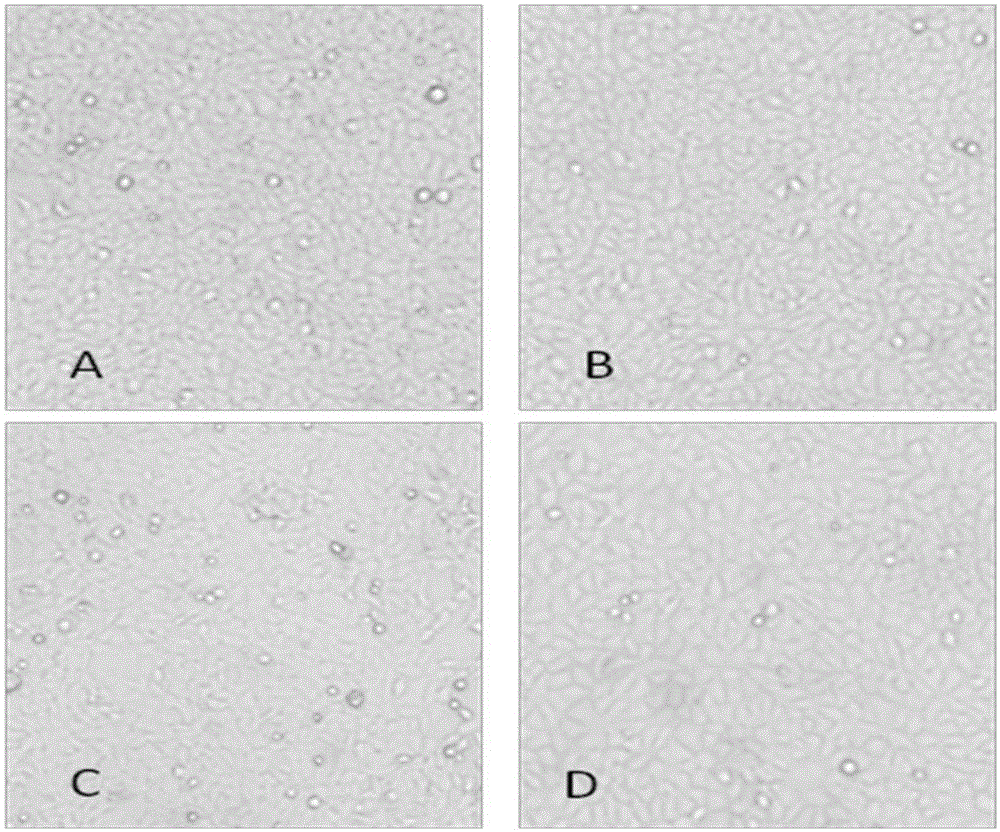 High-adaptability HEK293 clonal cell strains for recombinant adenovirus vaccine strains and application of high-adaptability HEK293clonal cell strains