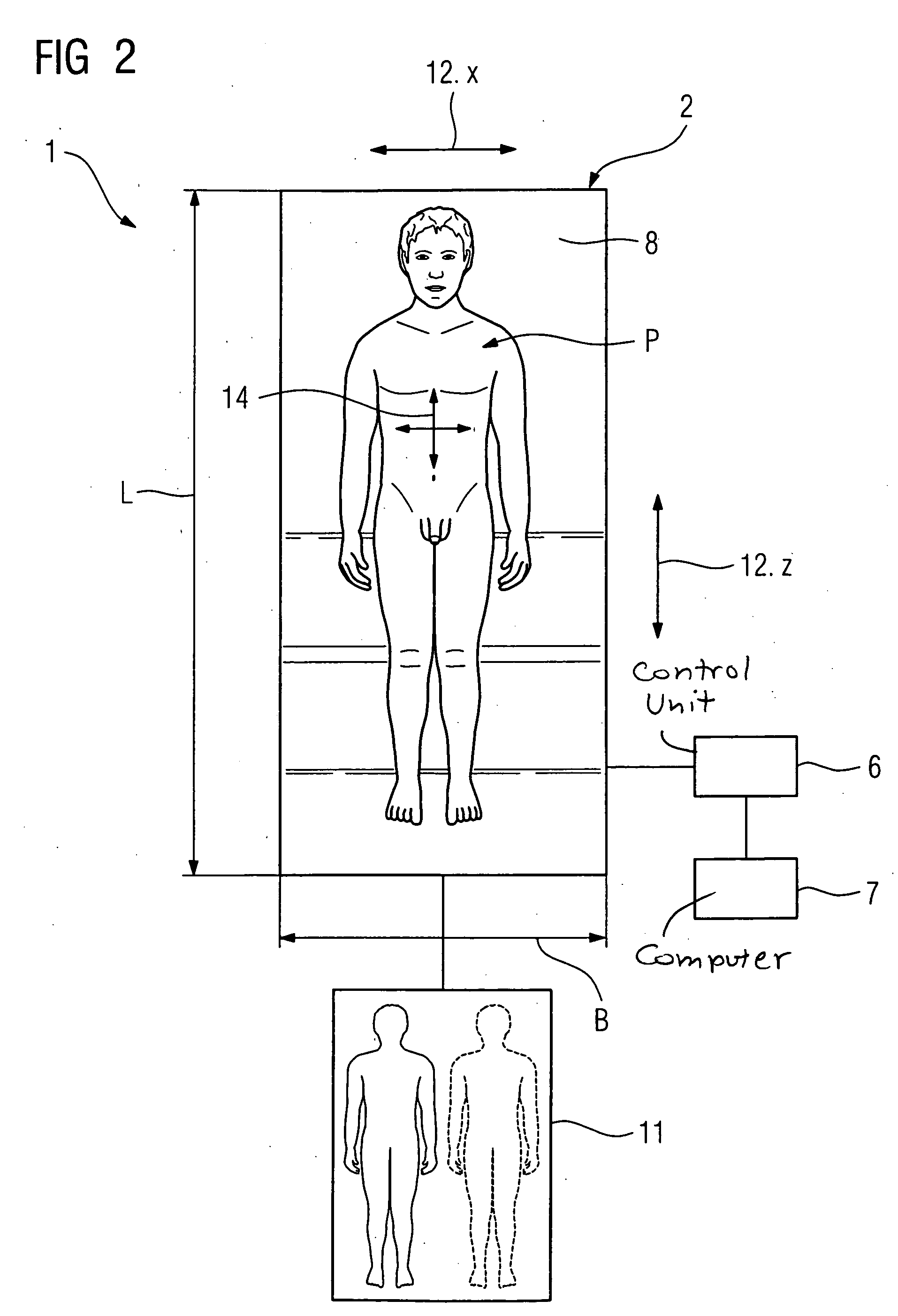 Patient bed, and method for reproducibly positioning and supporting a patient therewith