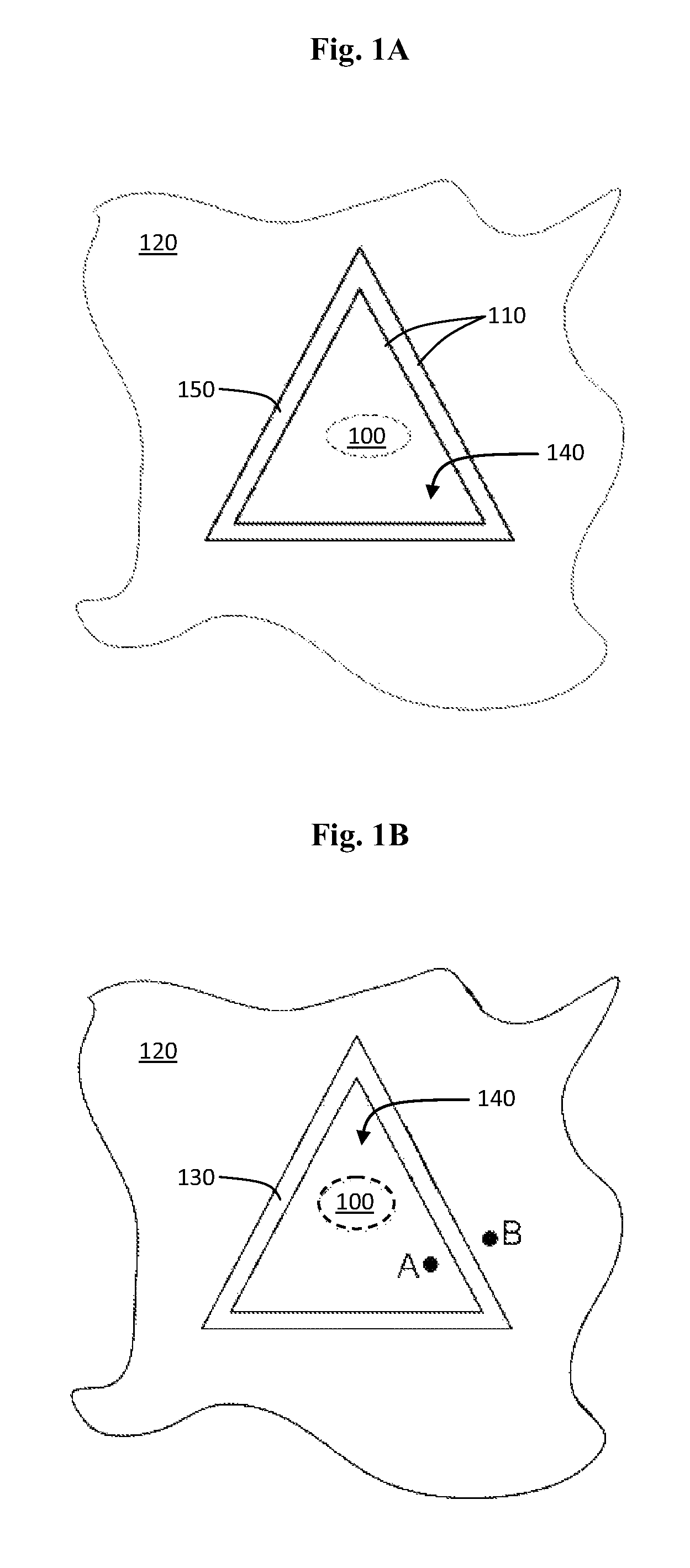 Method for decreasing the size and/or changing the shape of pelvic tissues