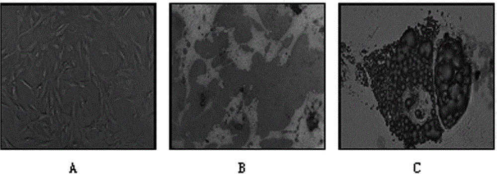 Application of mesenchymal stem cells and its extraction method in the preparation of medicines for psoriasis