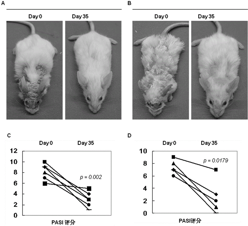 Application of mesenchymal stem cells and its extraction method in the preparation of medicines for psoriasis