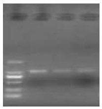 Method for extracting total DNA (Deoxyribose Nucleic Acid) of mixed chironomidae insect ecdysis on surface of water body