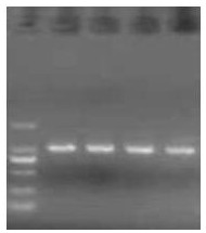 Method for extracting total DNA (Deoxyribose Nucleic Acid) of mixed chironomidae insect ecdysis on surface of water body