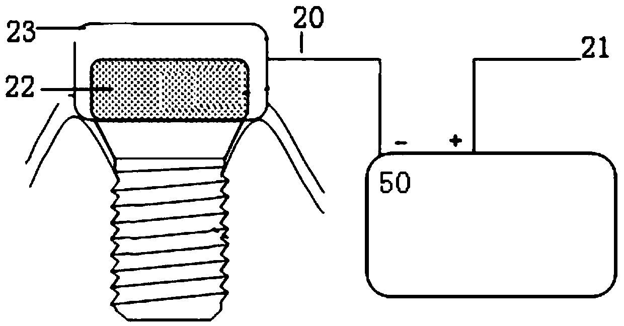Dental implant micro-electrical stimulation healing device