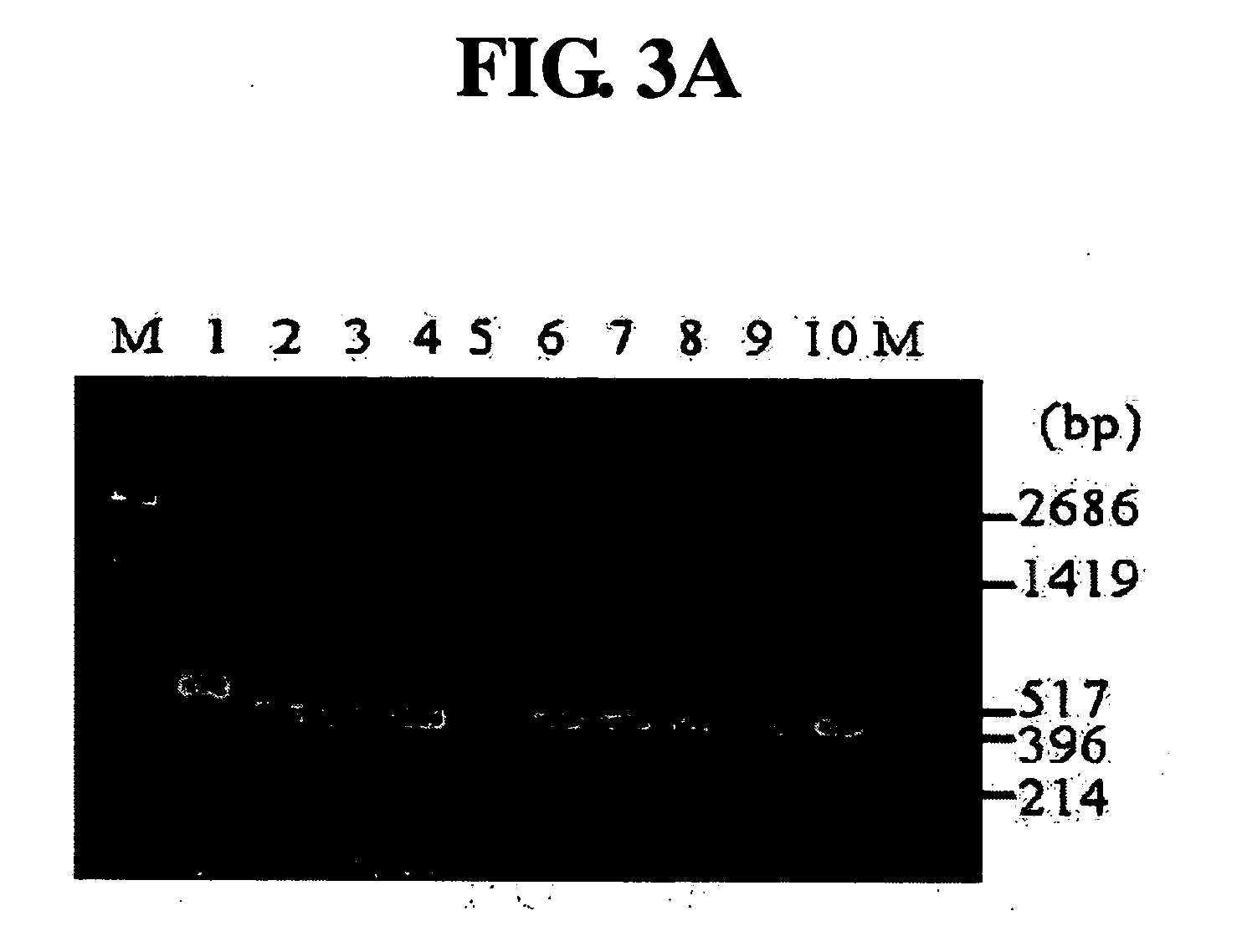 Diagnostic method for cancer characterized in the detection of the deletion of G-CSF exon 3