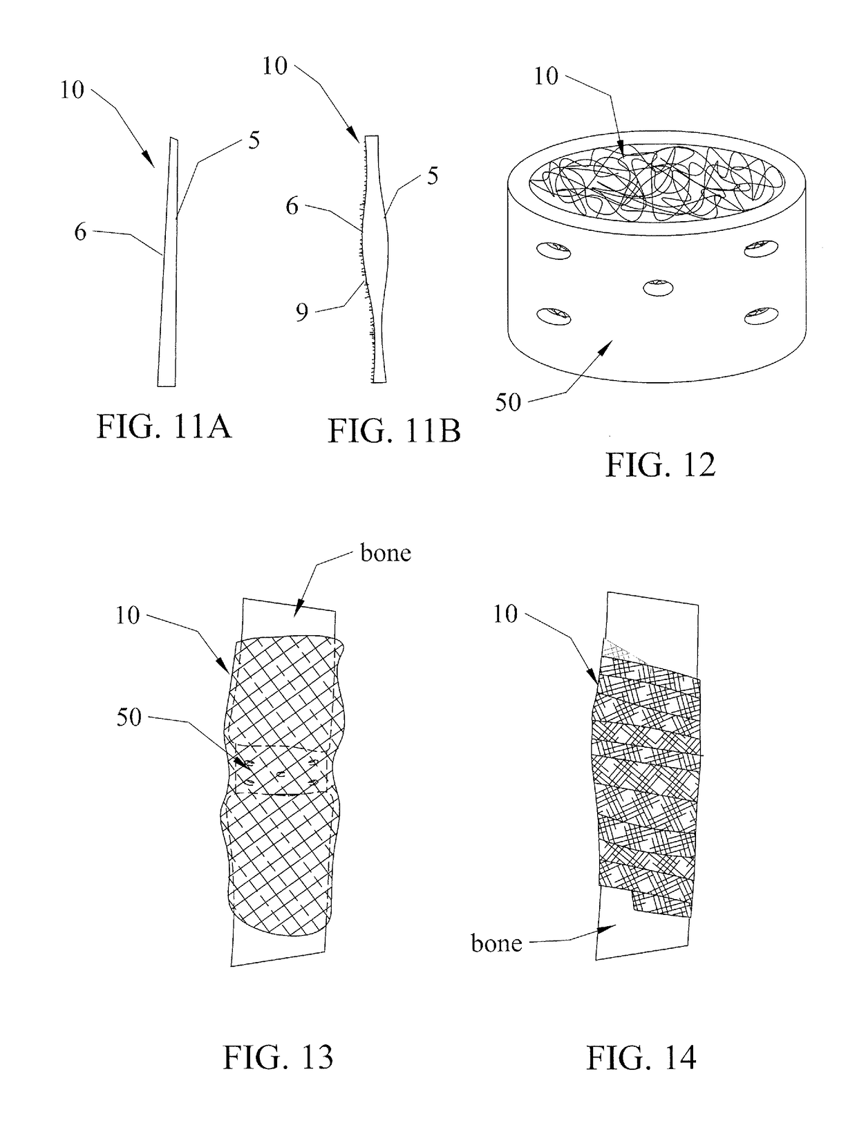 Implantable Metallic Sheet for Bone Repair