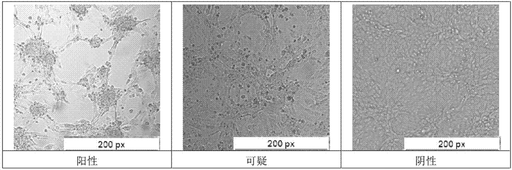 A method for detecting formaldehyde inactivation effect of toxin-producing Pasteurella multocida toxin by using Vero cells