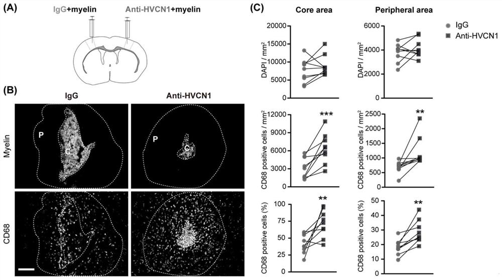 Application of HVCN1 antibody in preparation of medicine for treating nerve injury or neurodegenerative diseases